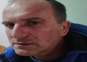 Prijetnje i zastrašivanje: Građanski aktivist koji je razotkrio probleme u vrtiću prebijen pred kućom.