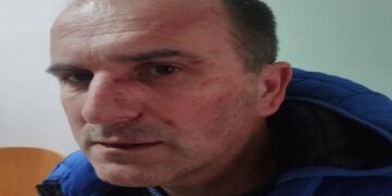 Prijetnje i zastrašivanje: Građanski aktivist koji je razotkrio probleme u vrtiću prebijen pred kućom.